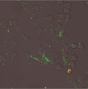 HeLa cells stained with Lactadherin after treatment with staurosporine 2 hour